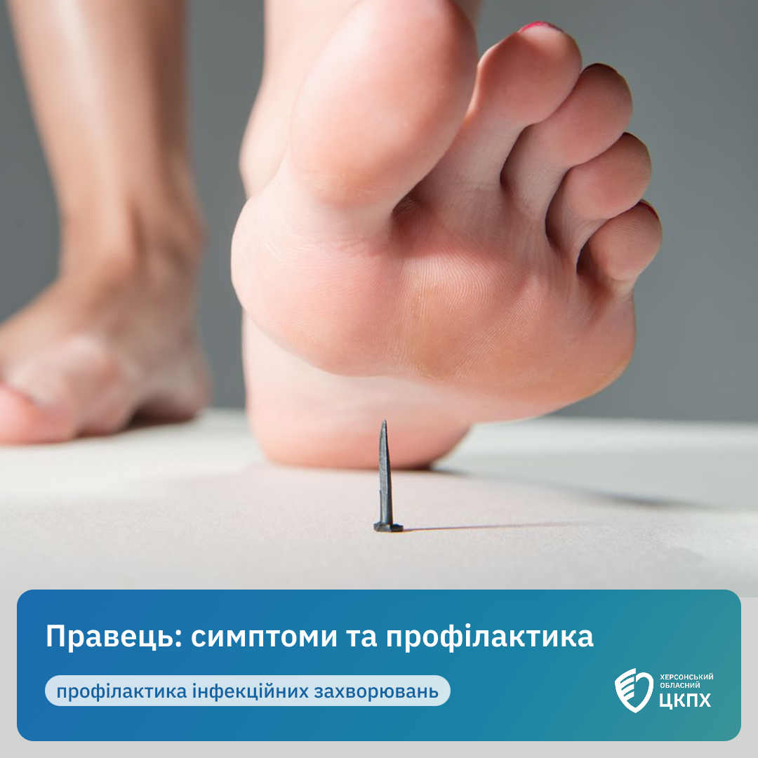 Гола стопа піднімається над гострою голкою на підлозі, ілюструючи тему правця та профілактики інфекційних захворювань.